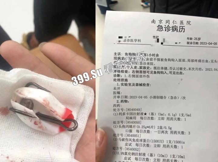 钓鱼佬篇  反正除了鱼啥都能钓到  就很离谱！-9